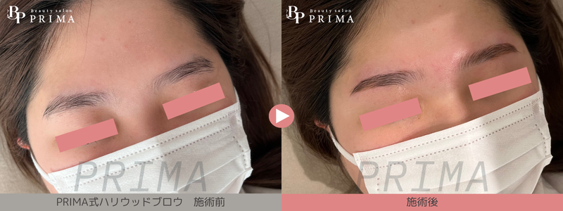 熊本プリマ、ハリウッドブロウリフト/結果写真1