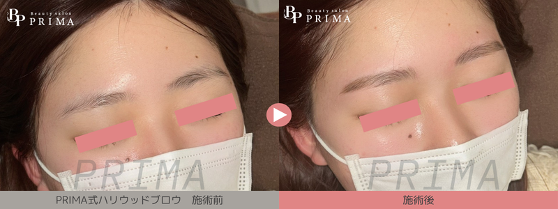 熊本プリマ、ハリウッドブロウリフト/結果写真2
